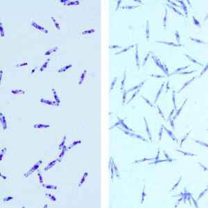 Coinfecção por nova espécie de parasita é confirmada em paciente com leishmaniose visceral