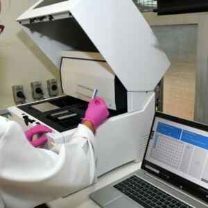 Maior estudo sobre epilepsia do mundo revela ‘arquitetura genética’ da doença e indica novas terapias