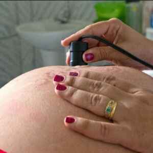 Mortalidade infantil por causas evitáveis tem menor índice em quase três décadas