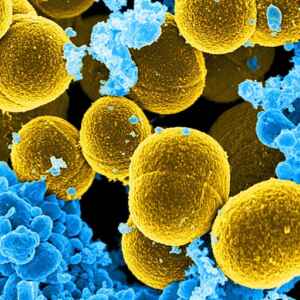 Terapia com luz reduz resistência de bactéria a antibióticos Bactéria