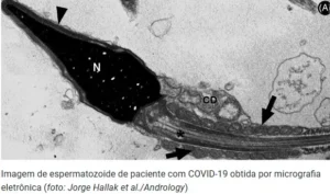 Captura-de-tela-2024-05-31-144858-300x177 Vírus da COVID-19 pode persistir no esperma até 110 dias após infecção