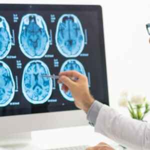 Tratamento contra Câncer de Cérebro Altera Comportamento do DNA Tumoral câncer