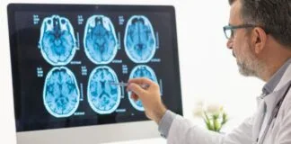 Tratamento contra Câncer de Cérebro Altera Comportamento do DNA Tumoral câncer