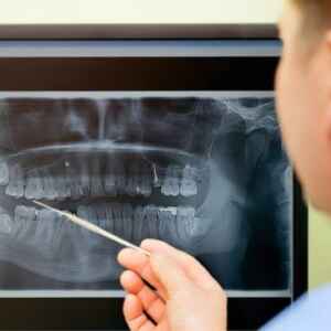 Pesquisa Relaciona Perda Dentária a Doenças Cardíacas Fatais pesquisa