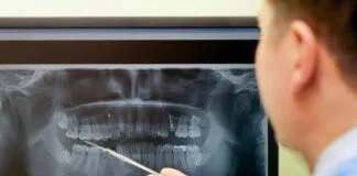 Pesquisa Relaciona Perda Dentária a Doenças Cardíacas Fatais pesquisa