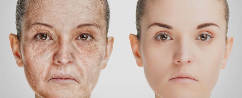 Agora sabemos que o envelhecimento epigenético acelerado está subjacente a essa relação