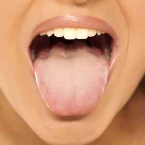 Diga ‘aaah’ e receba um diagnóstico da saúde na hora: este é o futuro dos exames?