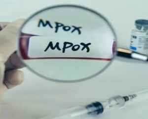 Vacina brasileira contra a mpox avança para testes em humanos mpox