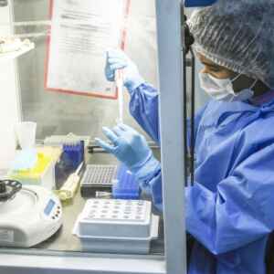 Fiocruz detecta ratos infectados por verme causador de meningite Fiocruz