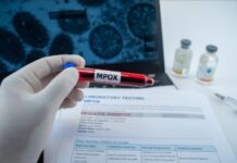 Vacina mRNA promete nova esperança na luta contra MPOX vacina