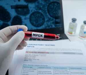 Vacina mRNA promete nova esperança na luta contra MPOX vacina