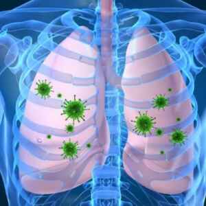 Prepararem-se para uma possível nova pandemia, desencadearam outra pandemia