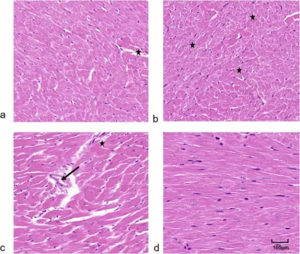 1-s2.0-S0147651324014593-gr3 Comer em embalagens plásticas de delivery pode aumentar risco de insuficiência cardíaca, alerta estudo
