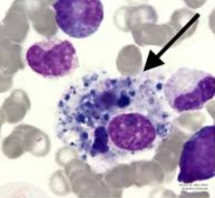 Screenshot-2025-04-15-161332 Como o exercício físico pode impedir que a dor muscular se torne crônica