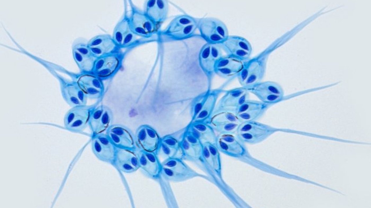 Micrografia de um organismo unicelular encontrado em um salmão, com estrutura circular e formato de saco.