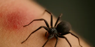5 sinais de picada de aranha que exigem atenção imediata