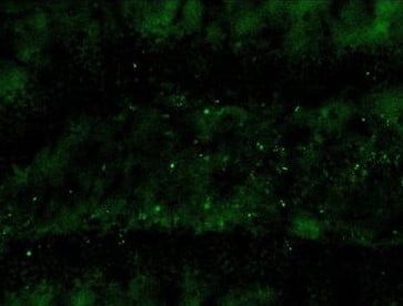 fito-2 Fitoterápico nanotecnológico com DNA da Amazônia pode frear o avanço do Alzheimer