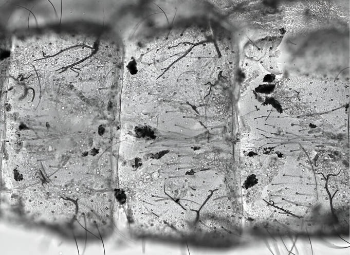 Aumento da temperatura acelera o envelhecimento dos mosquitos, enfraquecendo seus sistemas imunológicos. Como na visão aproximada do abdômen de um mosquito, que contém depósitos escuros de melanina