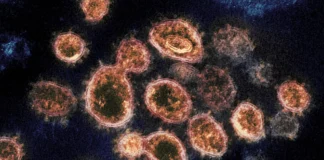 Fungos escondem soluções para crise antimicrobiana AP Photo / Instituto Nacional de Alergias e Doenças Infecciosas dos EUA, Laboratórios Rocky Mountain