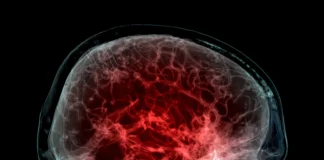 A ciência brasileira mapeia plásticos no cérebro do Sirius ao consultório Foto: Photograph Samunella