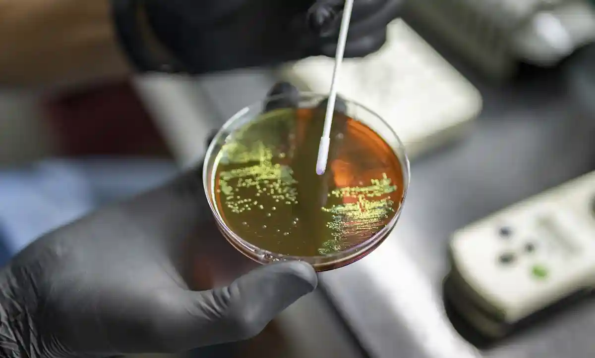 Na OMS/Sarah Pabst,no Instituto Malbrán, em Buenos Aires, Argentina, cientistas estudam amostras de bactérias de toda a América Latina para rastrear e controlar o surgimento da resistência antimicrobiana (RAM).