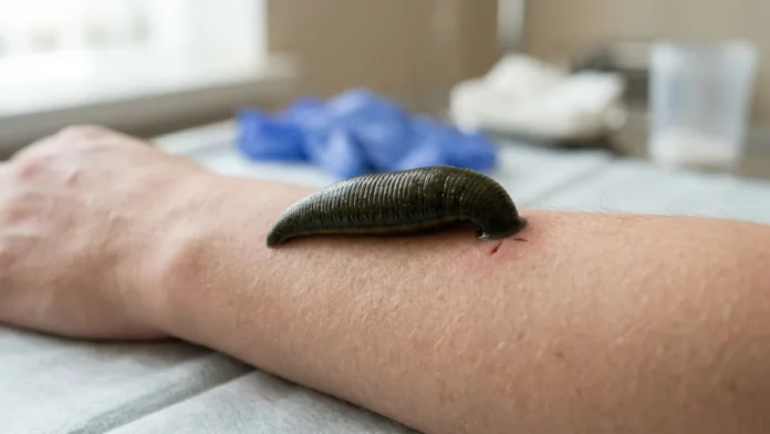 Sanguessuga corta a pele com três mandíbulas, libera hirudina e anestésico e mantém o sangue fluindo sem a vítima perceber Sanguessuga corta a pele com três mandíbulas, libera hirudina e anestésico e mantém o sangue fluindo sem a vítima perceber