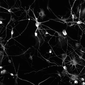 Estudo mostra que reciclagem das células muda com a idade conforme o sexo e o tecido analisado Estudo mostra que reciclagem das células muda com a idade conforme o sexo e o tecido analisado