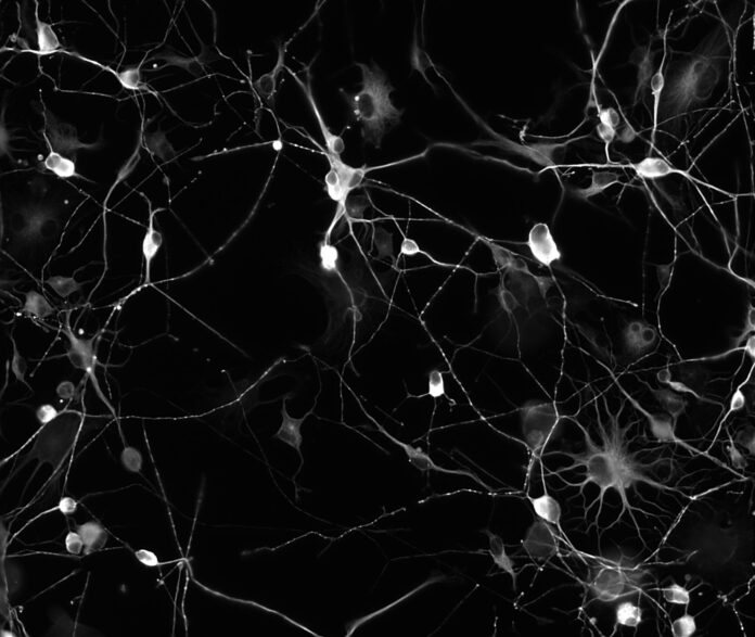 Estudo mostra que reciclagem das células muda com a idade conforme o sexo e o tecido analisado Estudo mostra que reciclagem das células muda com a idade conforme o sexo e o tecido analisado