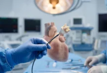 Válvulas de porco chegam à pesquisa cardíaca e ajudam a substituir cirurgias abertas por procedimentos menos invasivos Válvulas de porco chegam à pesquisa cardíaca e ajudam a substituir cirurgias abertas por procedimentos menos invasivos