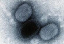 Vírus que causa lesões na pele carrega um gene do cérebro humano que saltou para ele há cerca de 100 mil anos Vírus que causa lesões na pele carrega um gene do cérebro humano que saltou para ele há cerca de 100 mil anos