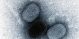 Vírus que causa lesões na pele carrega um gene do cérebro humano que saltou para ele há cerca de 100 mil anos Vírus que causa lesões na pele carrega um gene do cérebro humano que saltou para ele há cerca de 100 mil anos