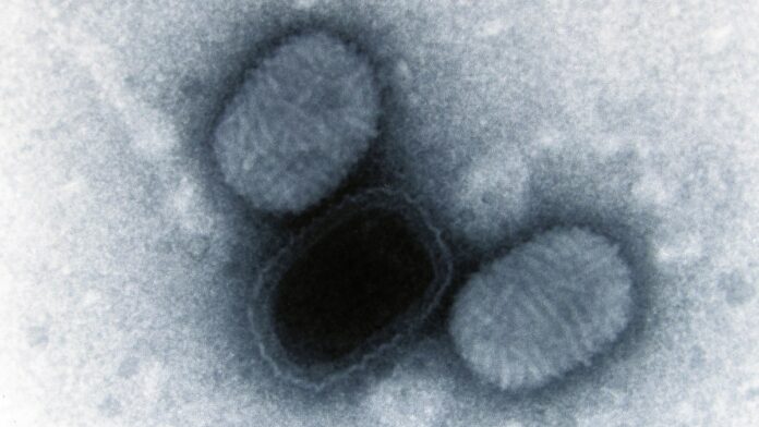 Vírus que causa lesões na pele carrega um gene do cérebro humano que saltou para ele há cerca de 100 mil anos Vírus que causa lesões na pele carrega um gene do cérebro humano que saltou para ele há cerca de 100 mil anos