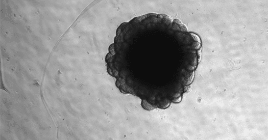 Vírus que infectou ancestrais há 5 milhões de anos deixou 158 cópias no DNA de chimpanzés e desligou um gene cerebral que humanos usam 1 Vírus que infectou ancestrais há 5 milhões de anos deixou 158 cópias no DNA de chimpanzés e desligou um gene cerebral que humanos usam