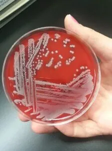 Captura-de-tela-2024-05-28-105545-224x300 Terapia com luz reduz resistência de bactéria a antibióticos