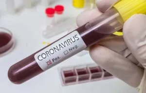 20200228070742-300x191 Descoberto gene que pode oferecer proteção contra a COVID-19