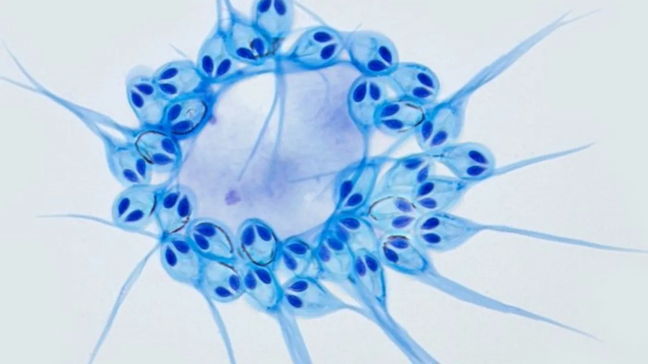 micrografia-de-um-organismo-unicelular-encontrado-em-um-salmao-com-estrutura-circular-e-formato-de-saco-20250520232415 Descoberto no salmão: um ser vivo que não respira oxigênio nem possui mitocôndrias